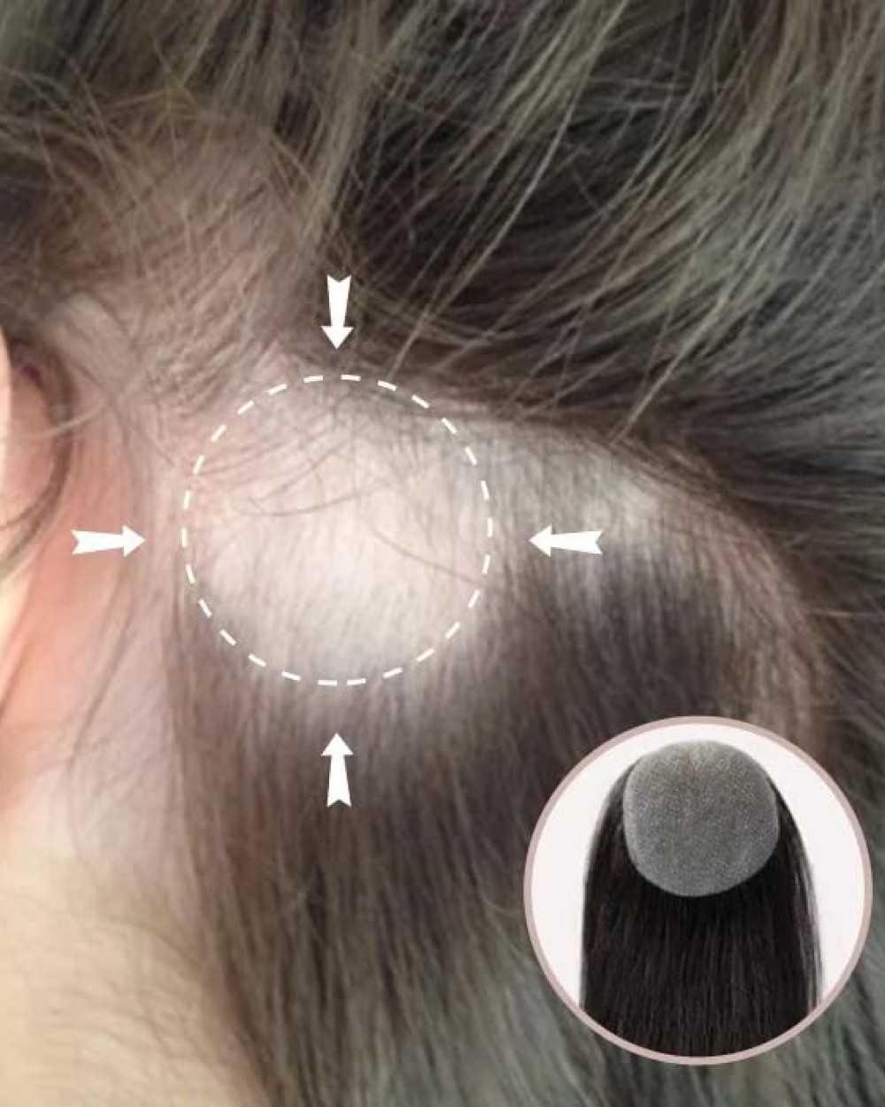 Full Skin Base CoverUp Hair Patches Pieces No Surgical Solution For