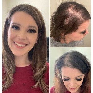 Upgraded Real Human Hair Top Hairpieces For Women Upgraded Real Human Hair Top Hairpieces For Women